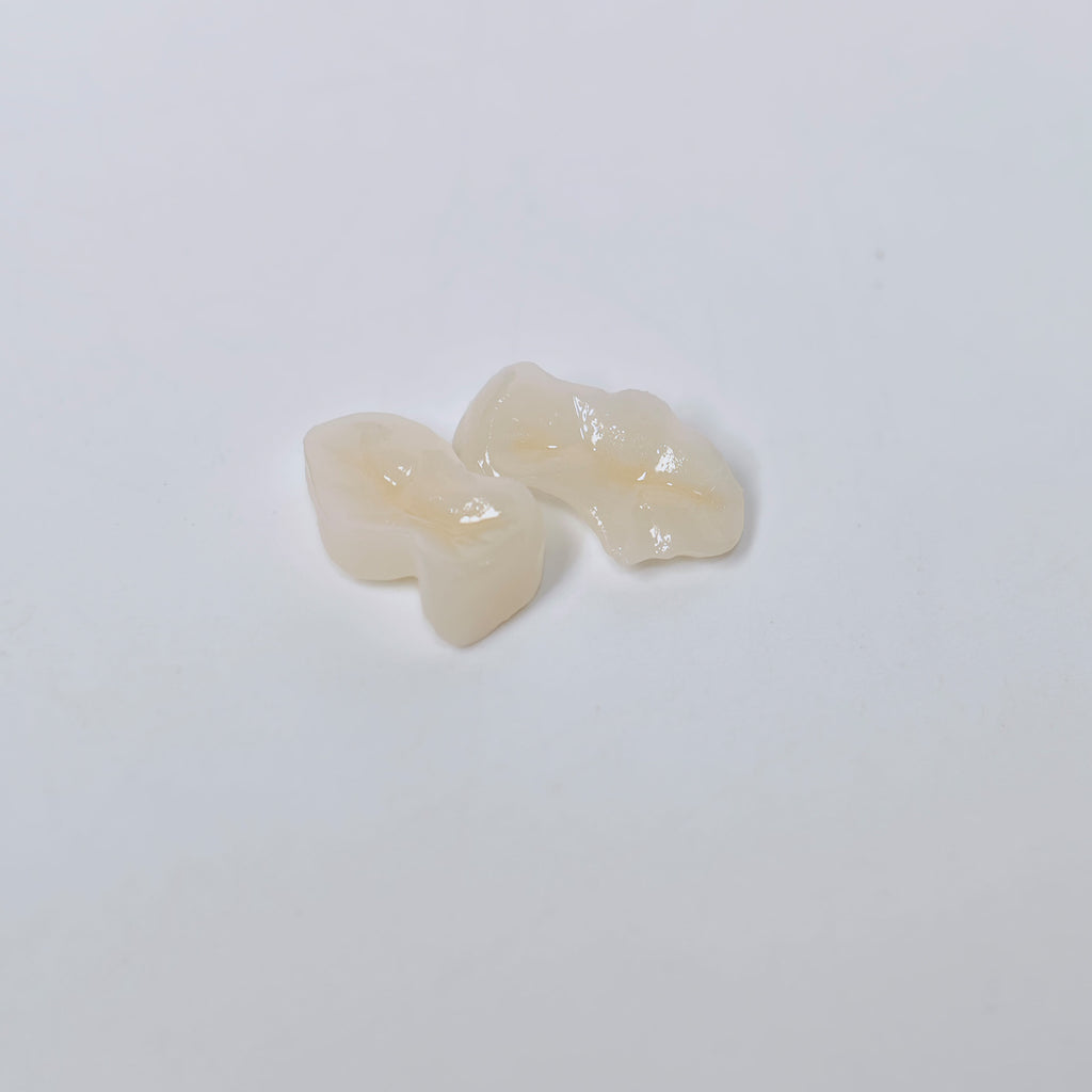 Full-Zirconia Laying With Cement-Retained