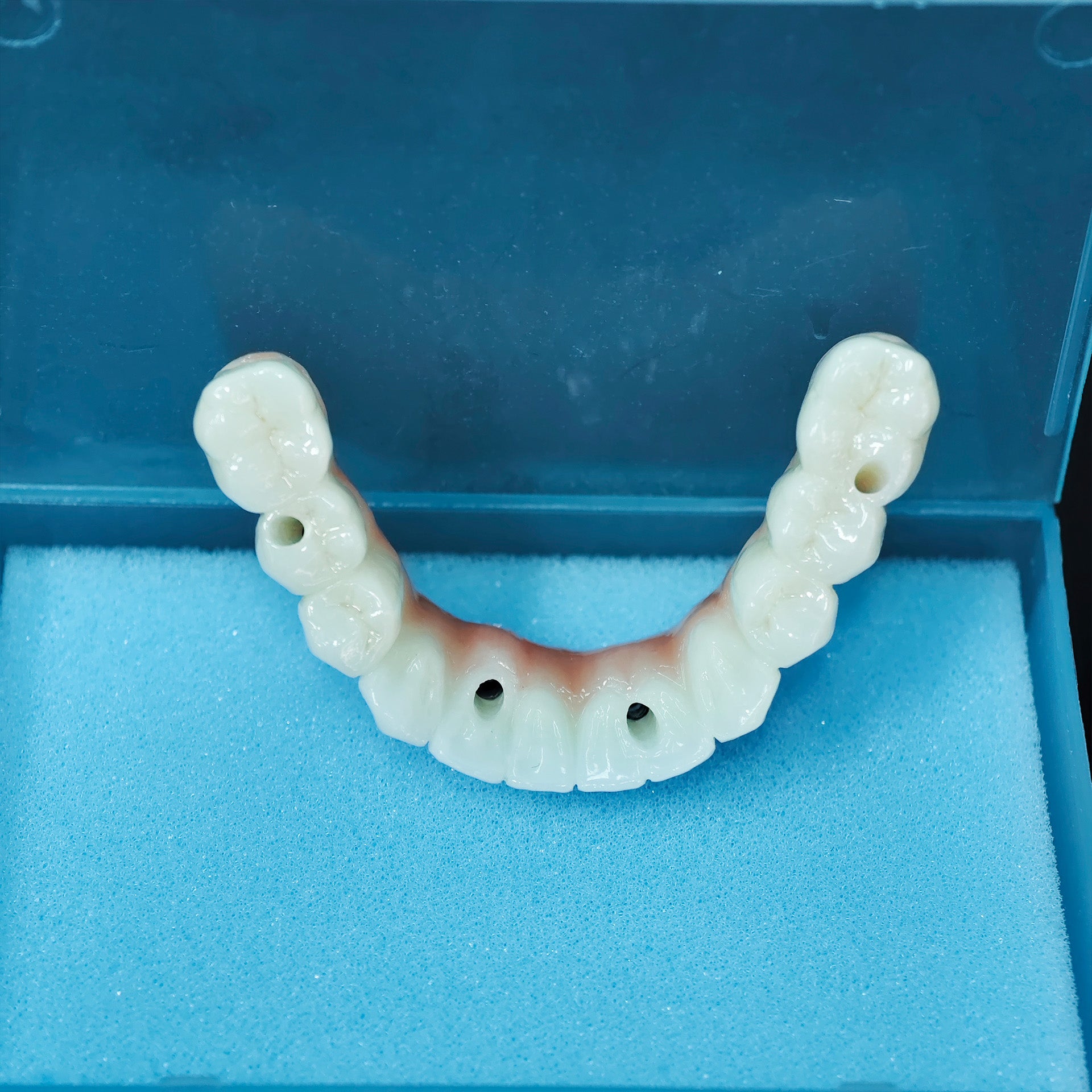 Zirconia Bridge With Ti-Base Abutment