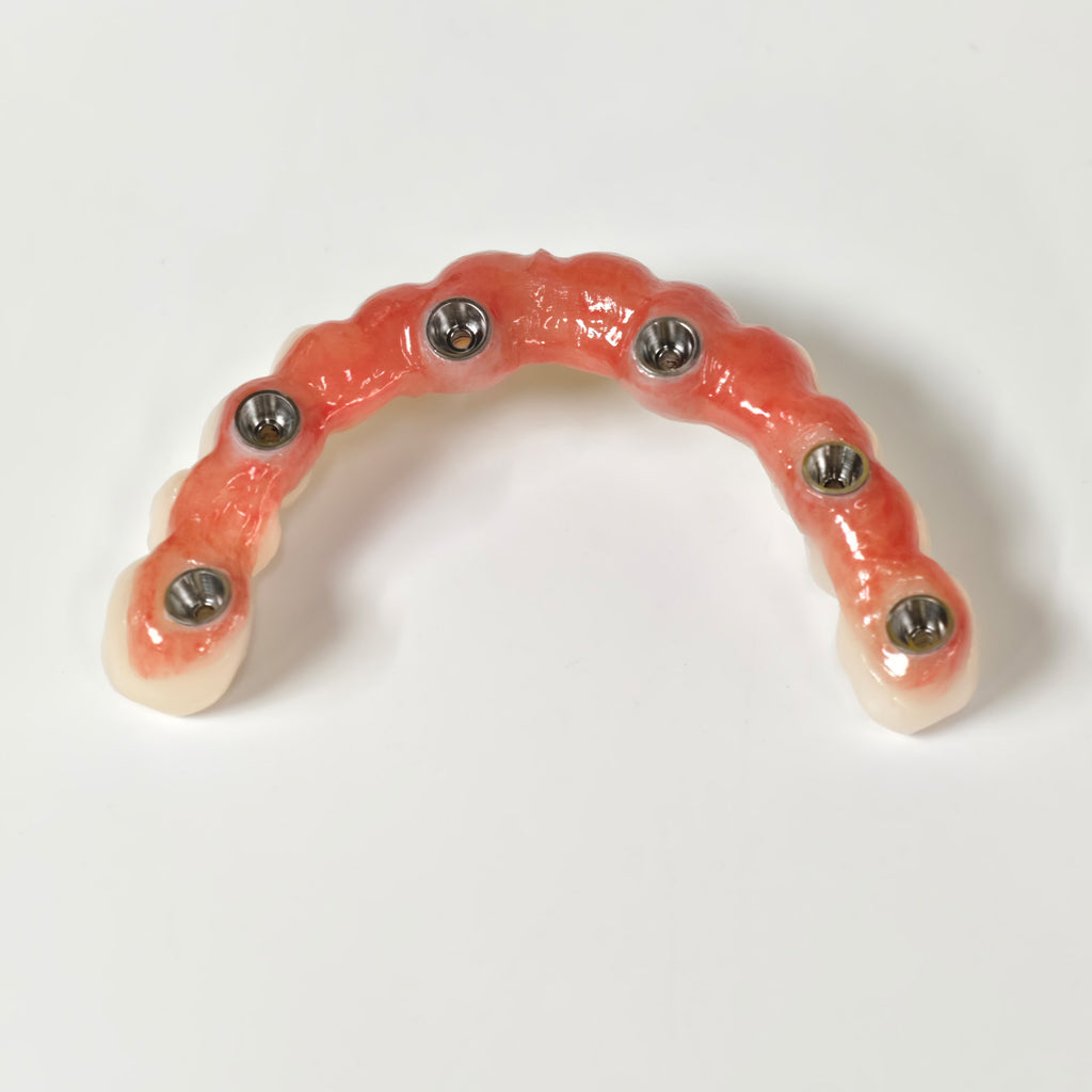 All On 6 Zirconia Bridge With Ti-Base Screw Retained