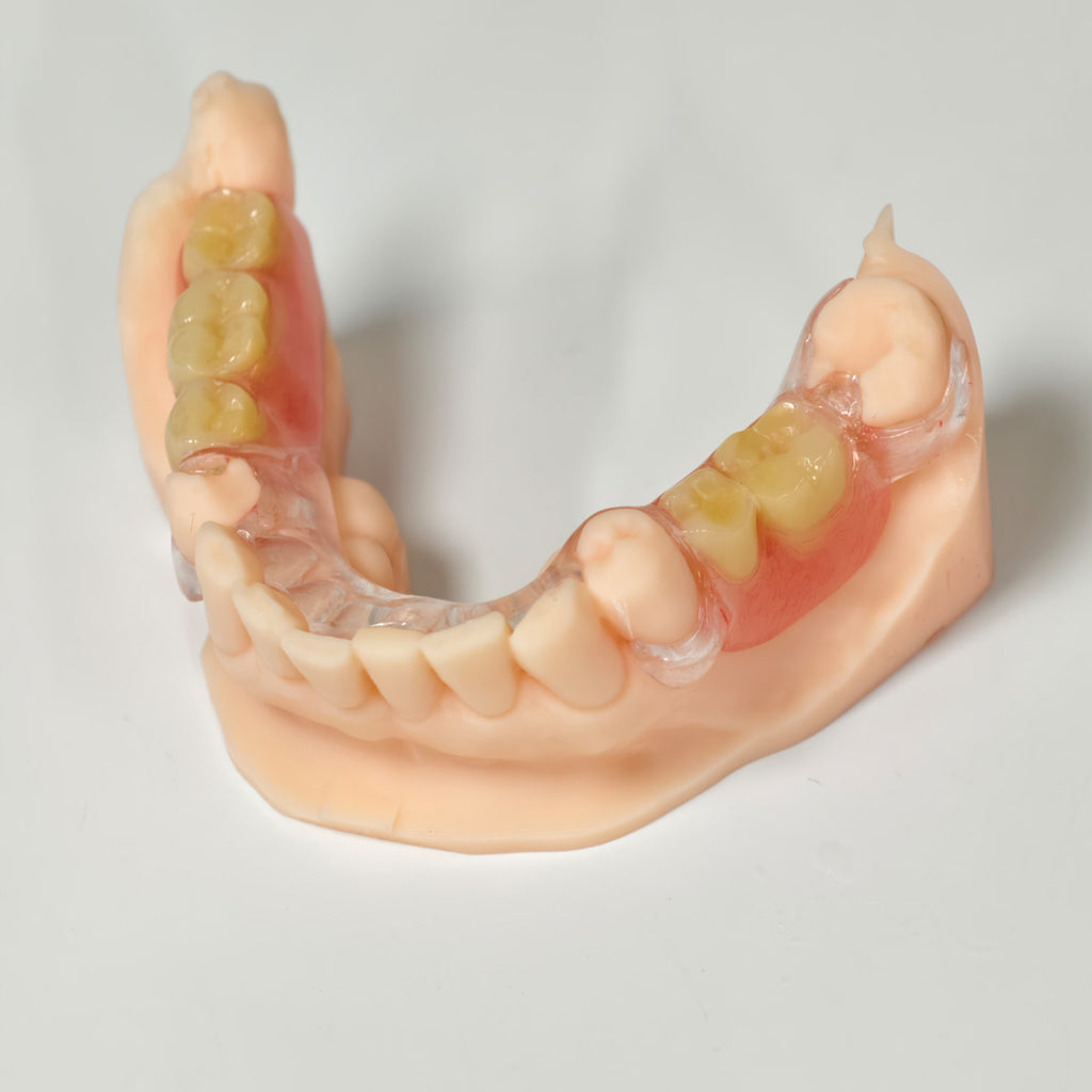 Clear Framework With Acrylic Denture Aesthetic Denture