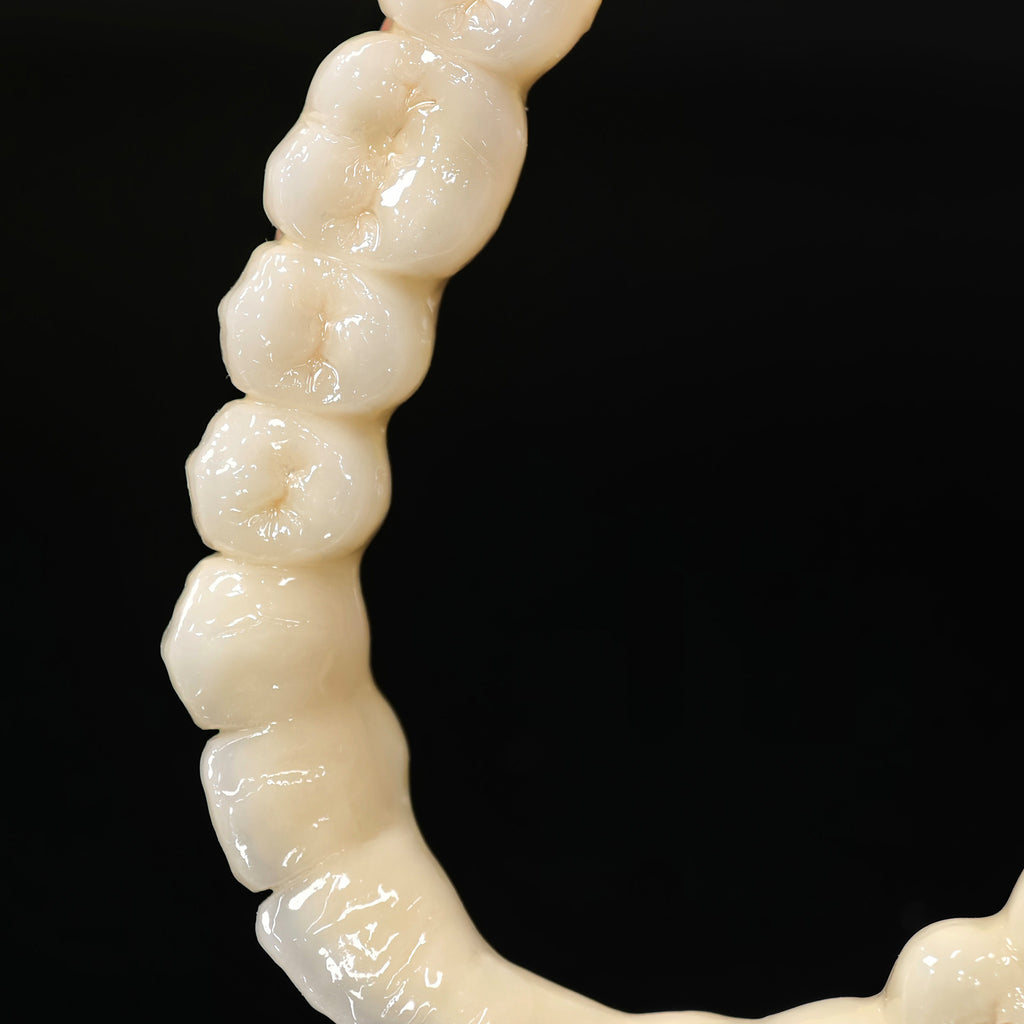 Co - Cr PFM Dental Bridge
