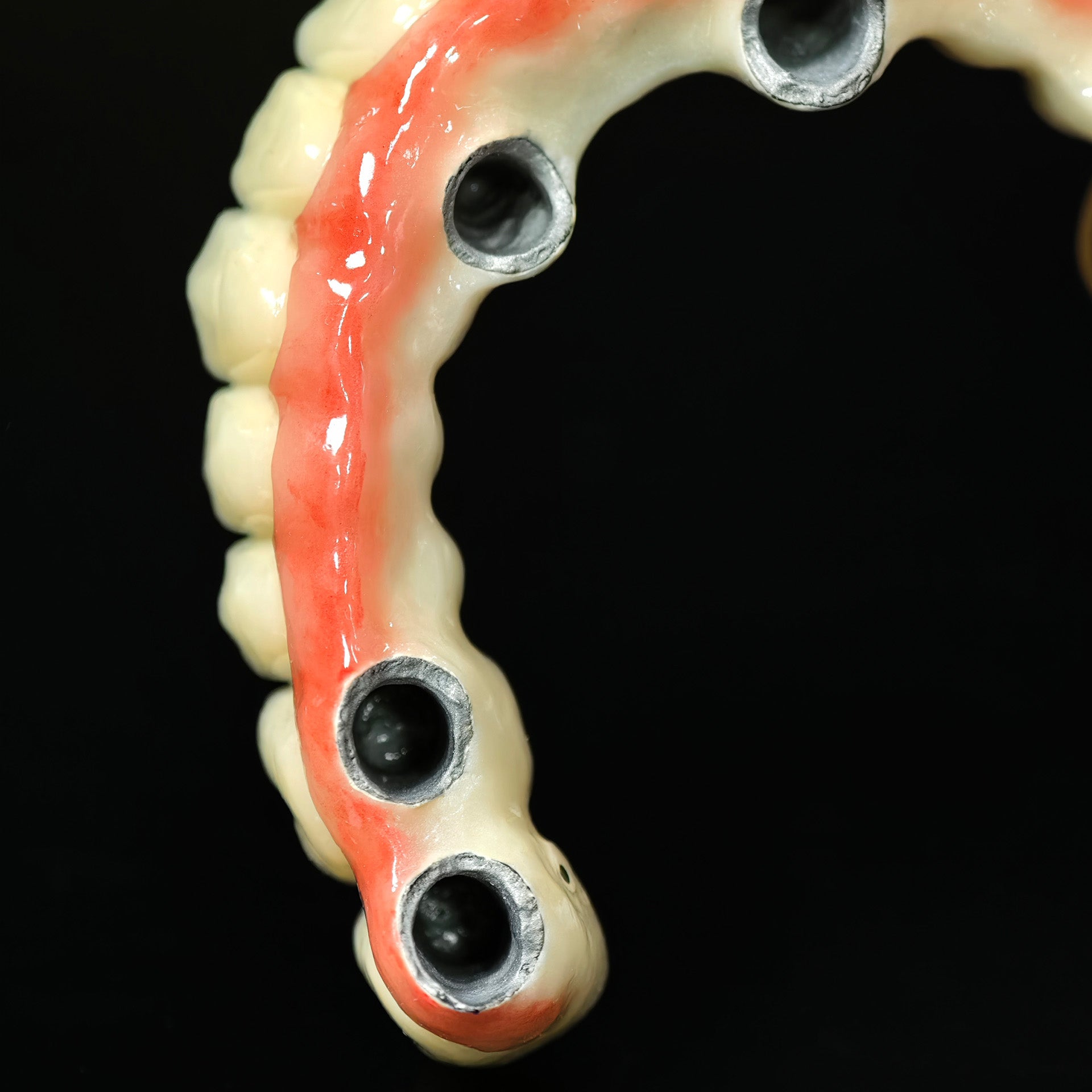 Co - Cr PFM Dental Bridge