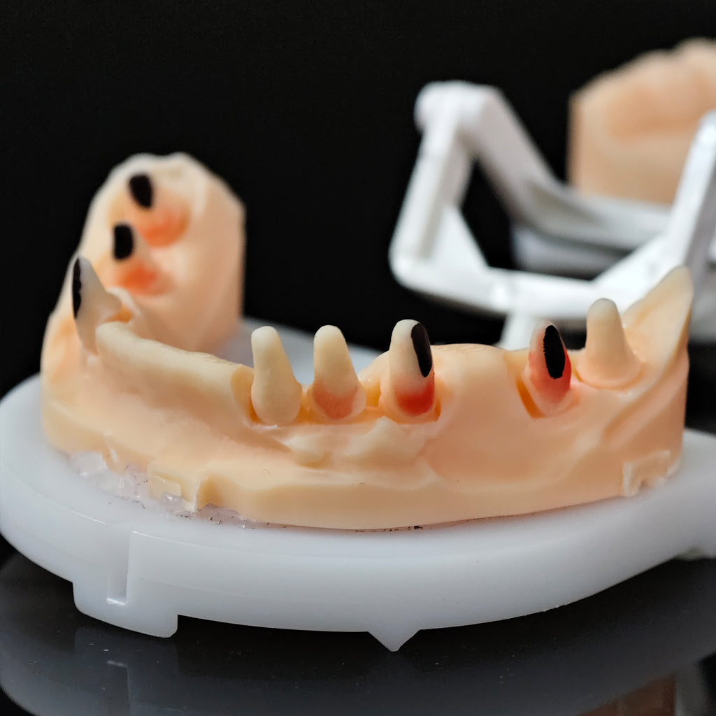 Co - Cr PFM Dental Bridge