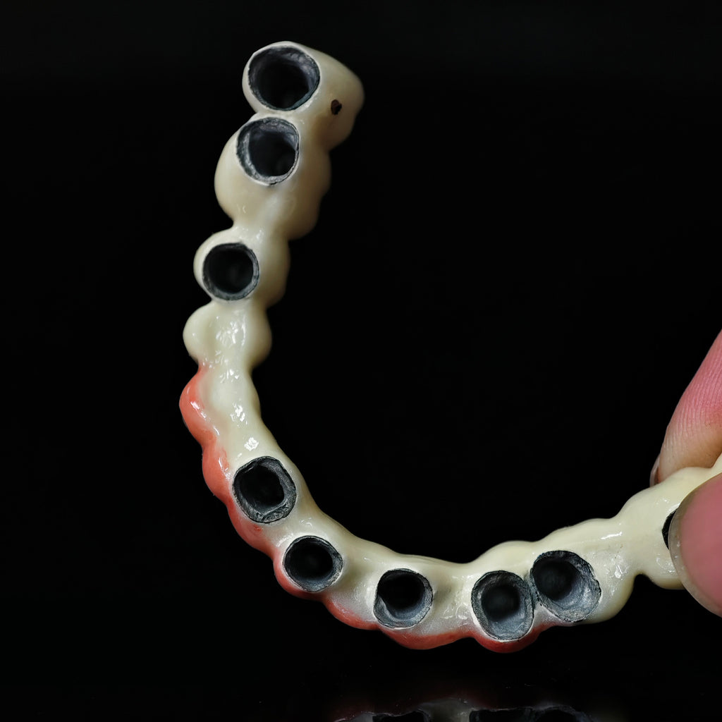 Co - Cr PFM Dental Bridge