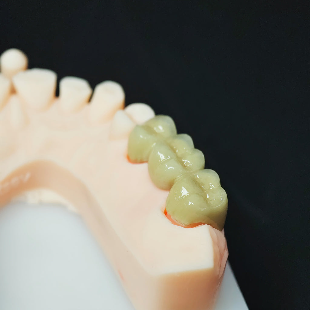 Co - Cr Pfm Dental Crowns And Bridge