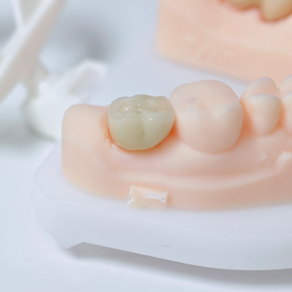 Co - Cr Pfm Dental Crowns And Bridge