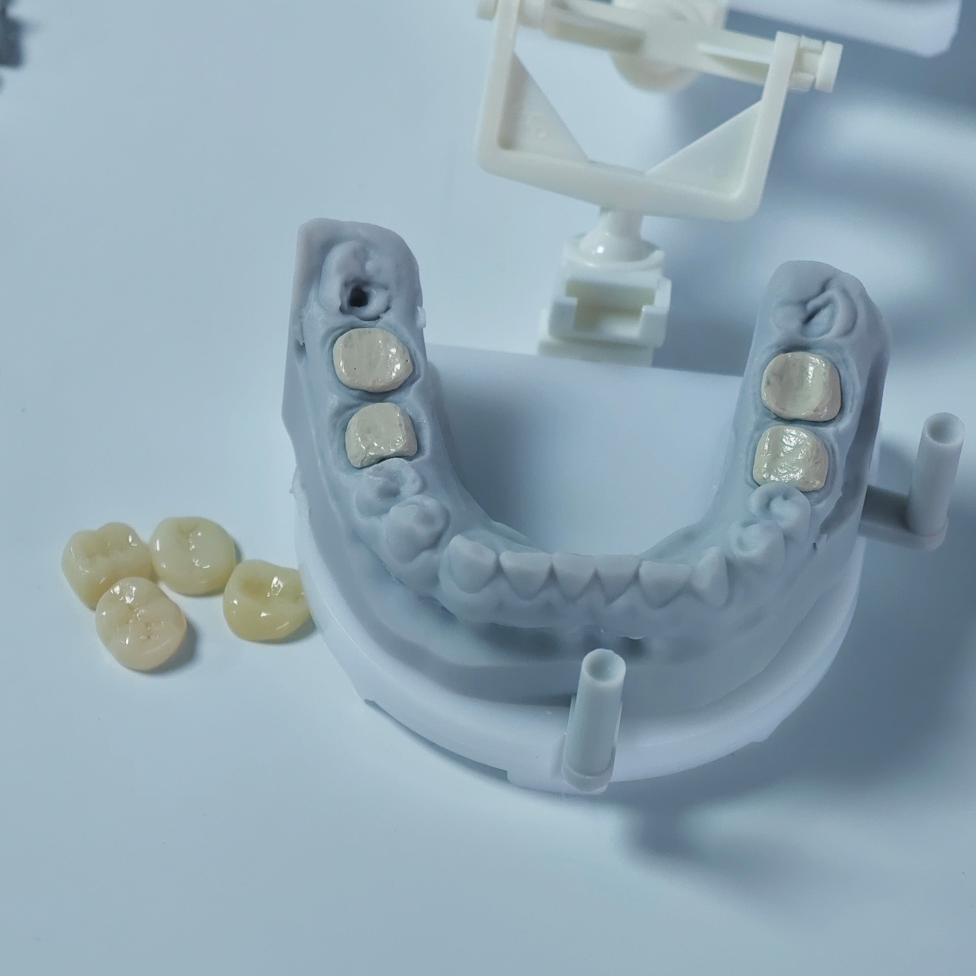 Co - Cr PFM Dental Crowns With Metal Post-And-Core
