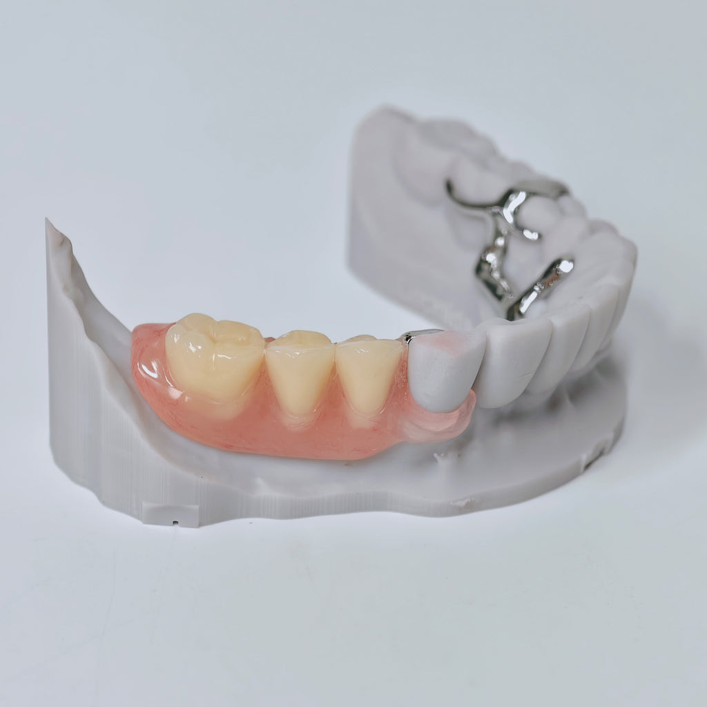 Cobalt Chrome Framework Denture Metal Framework With Acrylic Denture