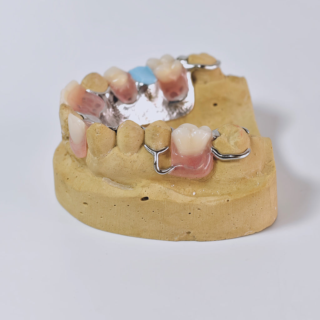 Cobalt Chrome Framework Denture Metal Framework With Acrylic Denture