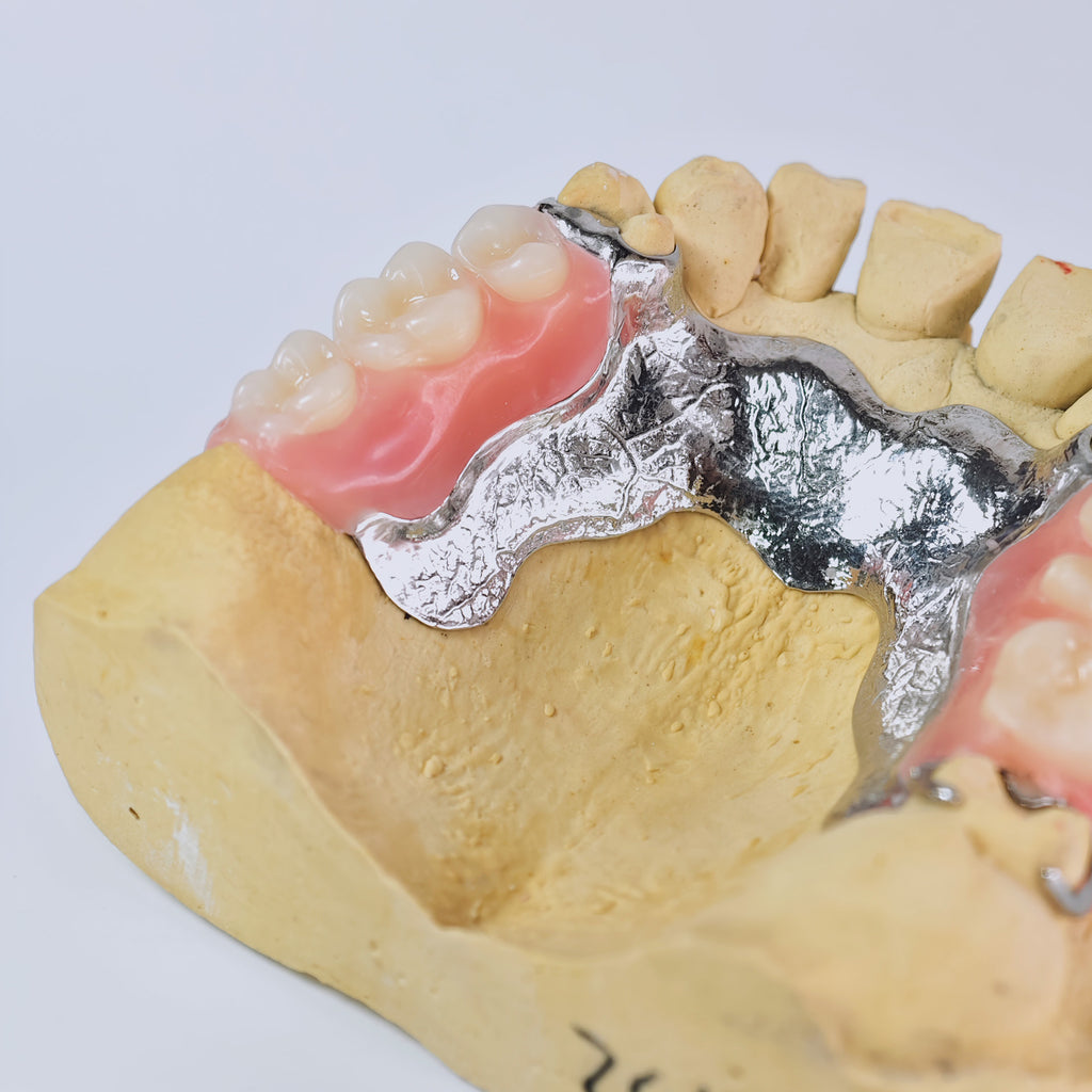 Cobalt Chrome Framework Denture Metal Framework With Acrylic Denture
