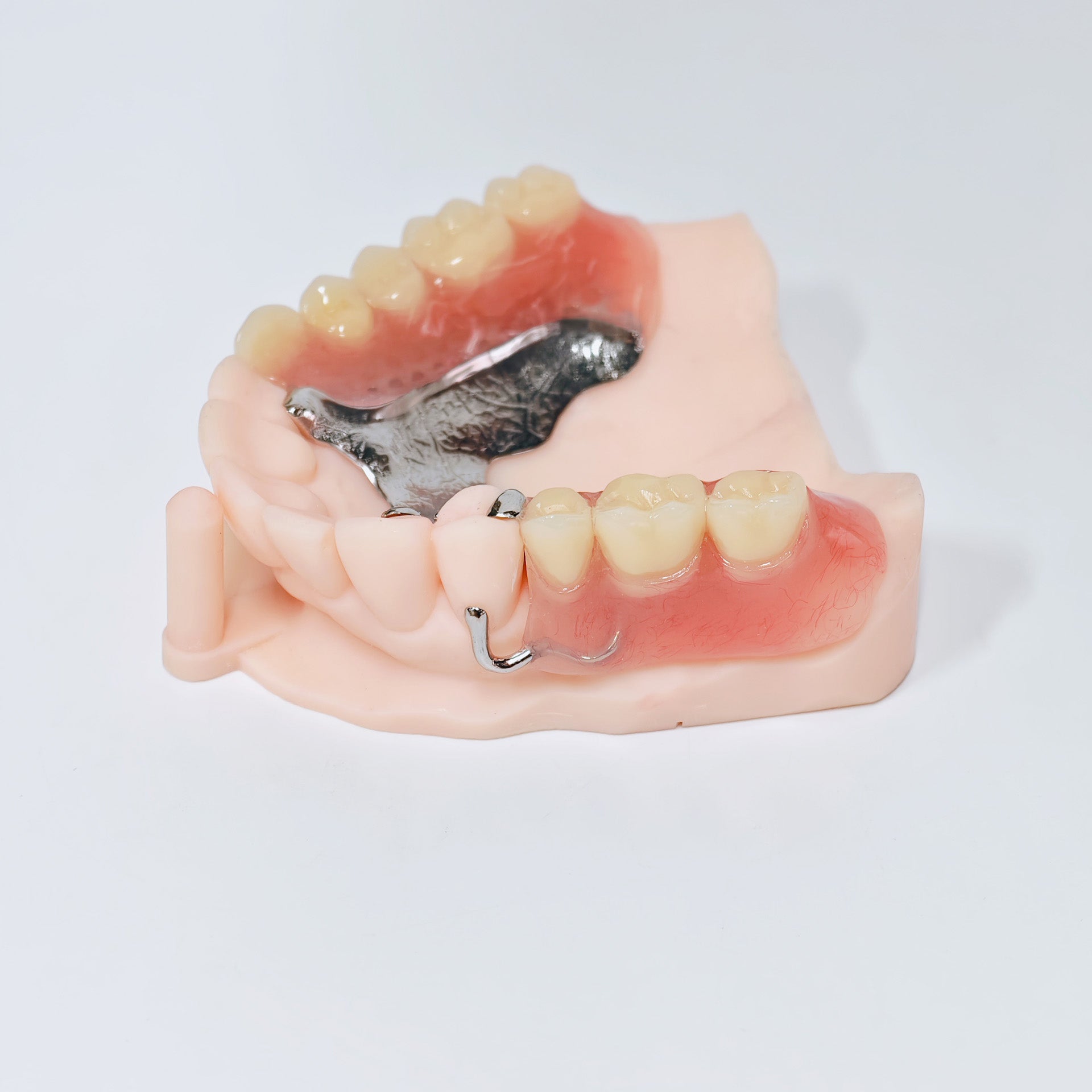 Cobalt Chrome Framework Denture Metal Framework With Acrylic Denture