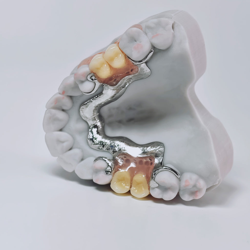 Cobalt Chrome Framework Denture Metal Framework With Acrylic Denture