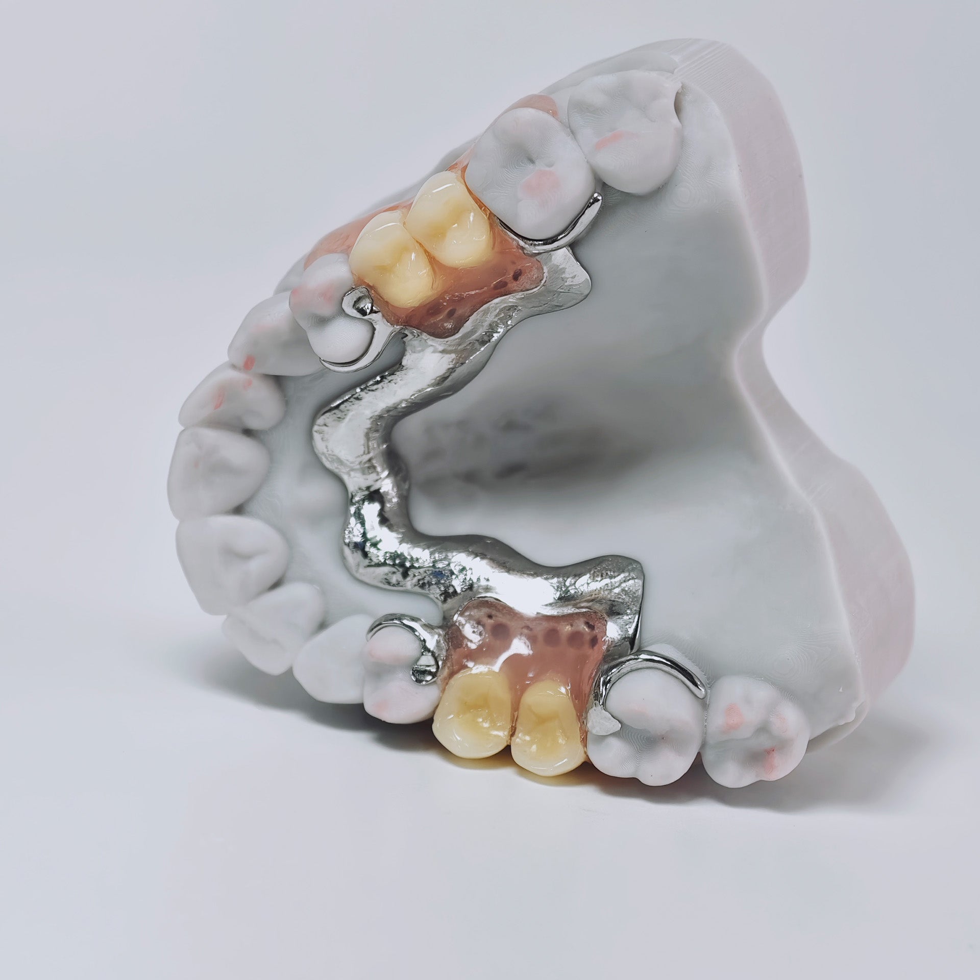 Cobalt Chrome Framework Denture Metal Framework With Acrylic Denture
