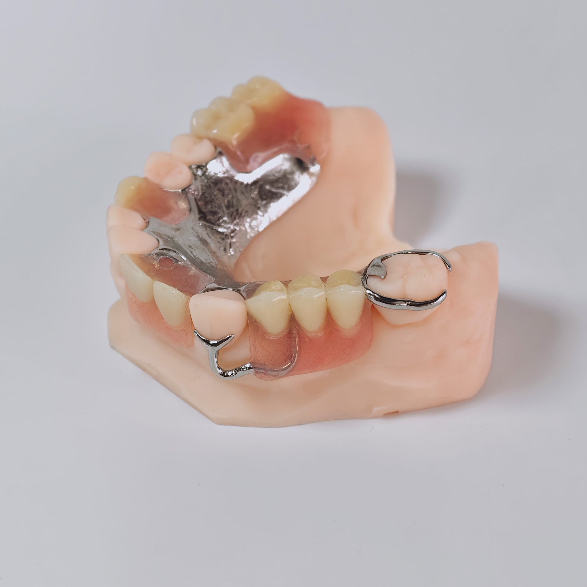 Cobalt Chrome Framework Denture Metal Framework With Acrylic Denture