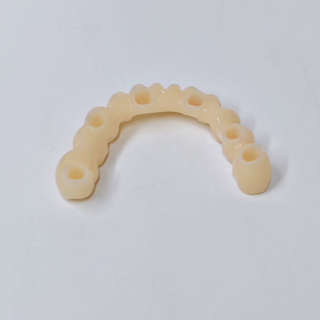 Custom Abutment And PMMA Bridge With Cement Retained And Implant Seating Guide