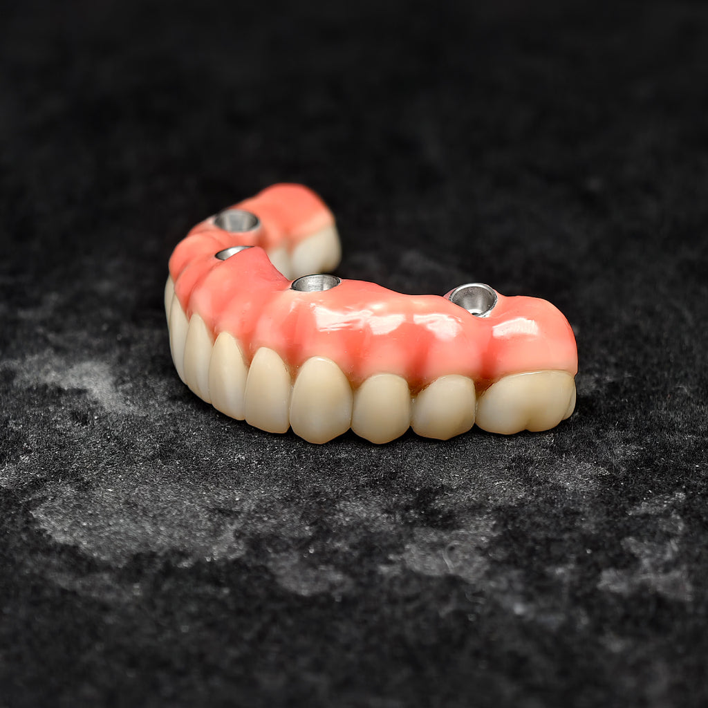 Enhanced Zirconia Crown Malo Bridge
