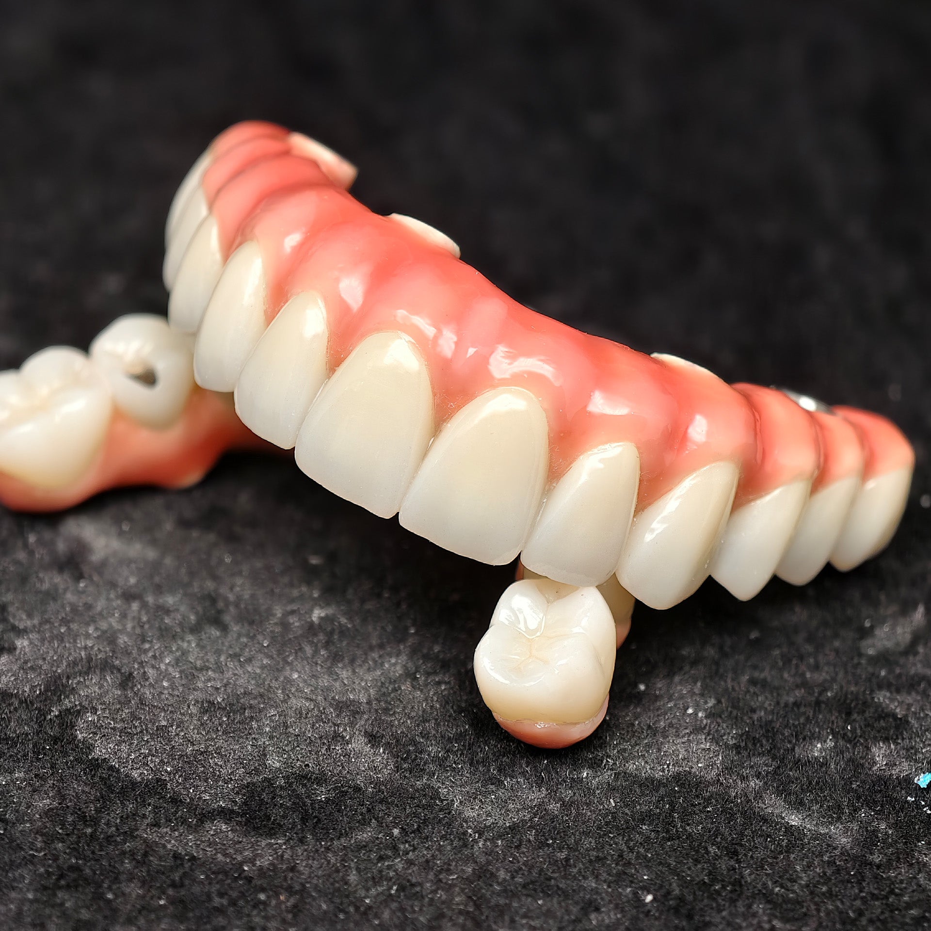 Enhanced Zirconia Crown Malo Bridge