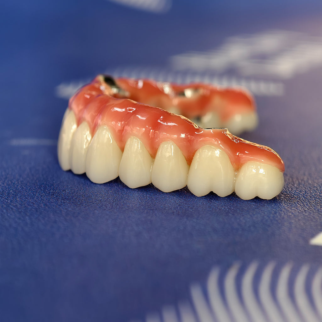 Enhanced Zirconia Crown Malo Bridge