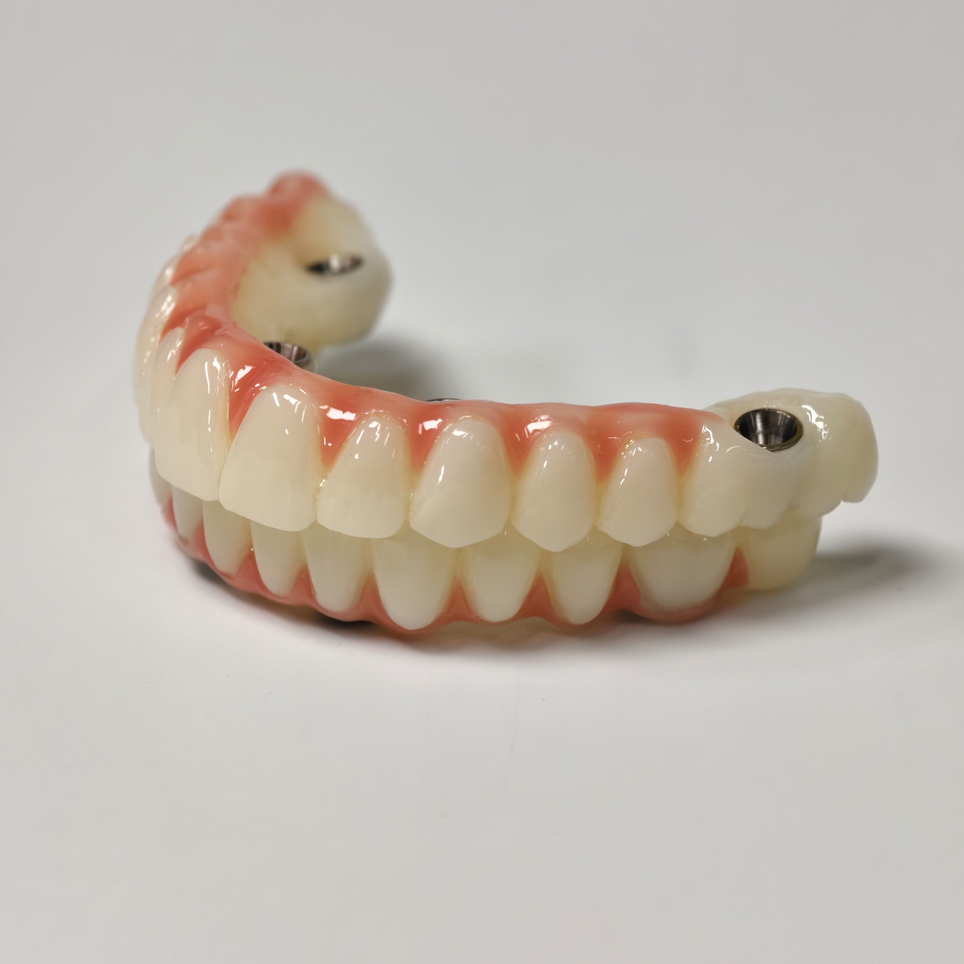 Full-Arch PMMA Bridge With Ti-Base Screw Retained