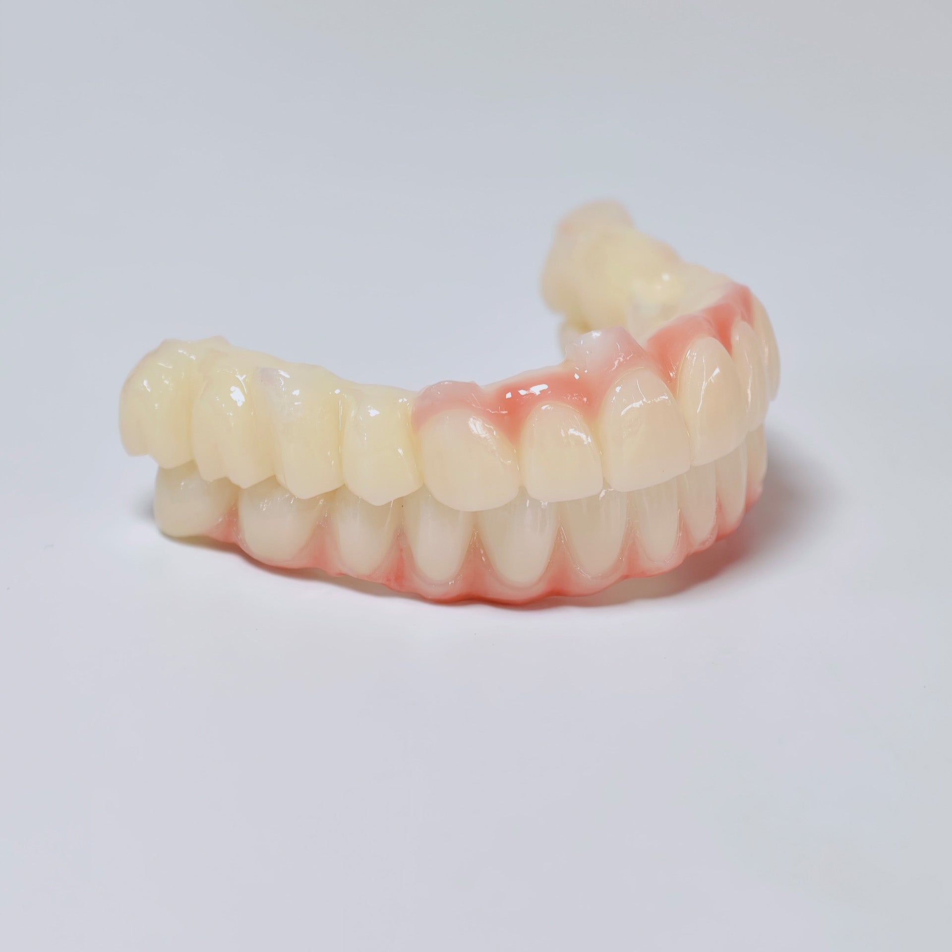 Full-Arch Zirconia Bridge And PMMA Bridge With Cement Retained