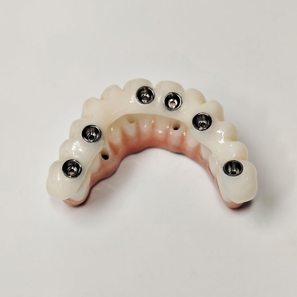 Full-Arch Zirconia Bridge With Ti-Base Abutment