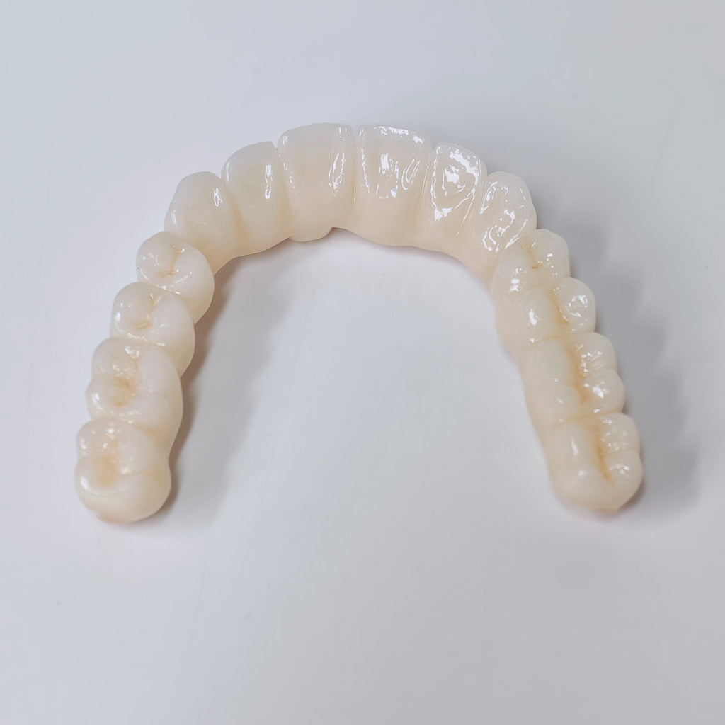 Half-Mouth Zirconia Bridge With Cement-Retained