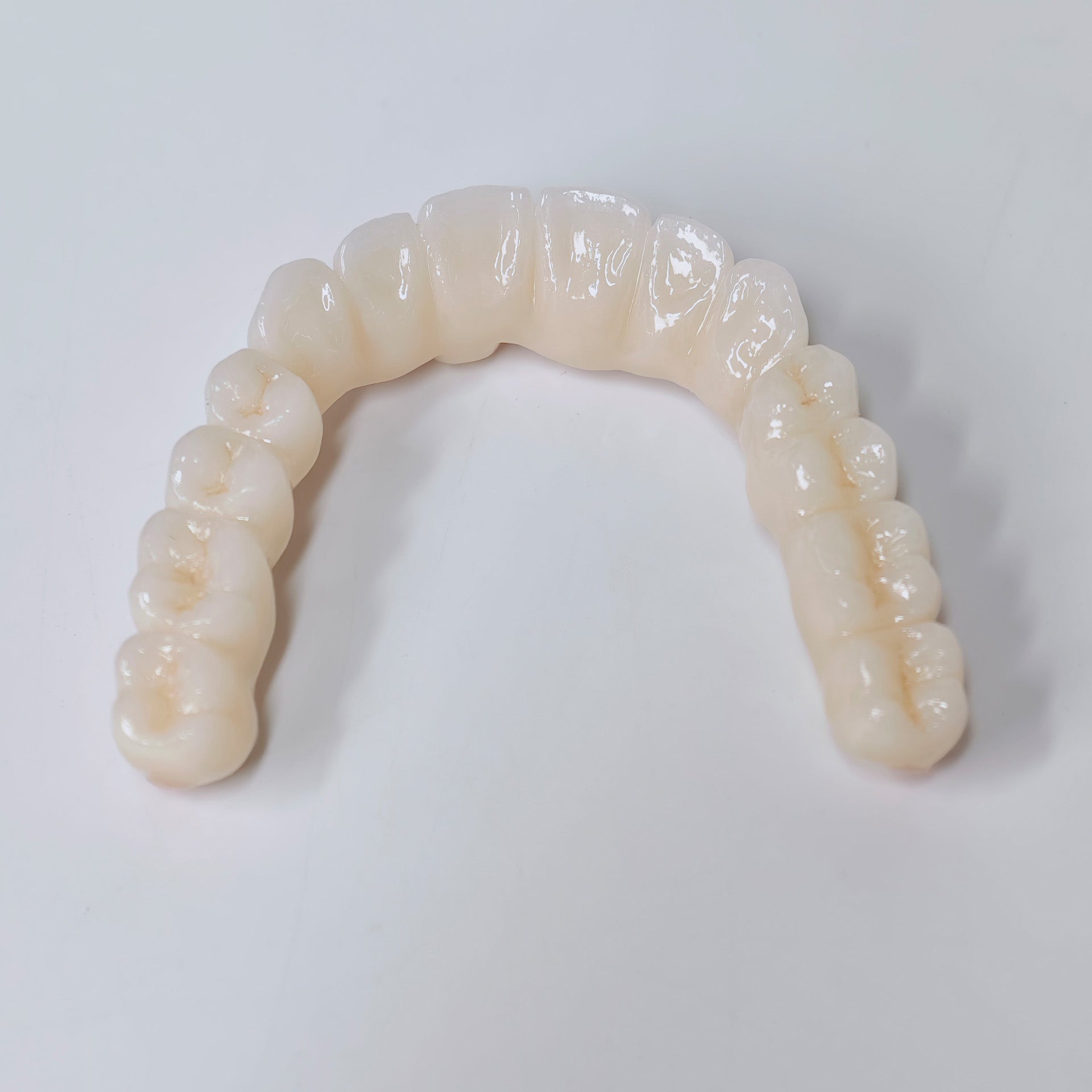 Half-Mouth Zirconia Bridge With Cement-Retained