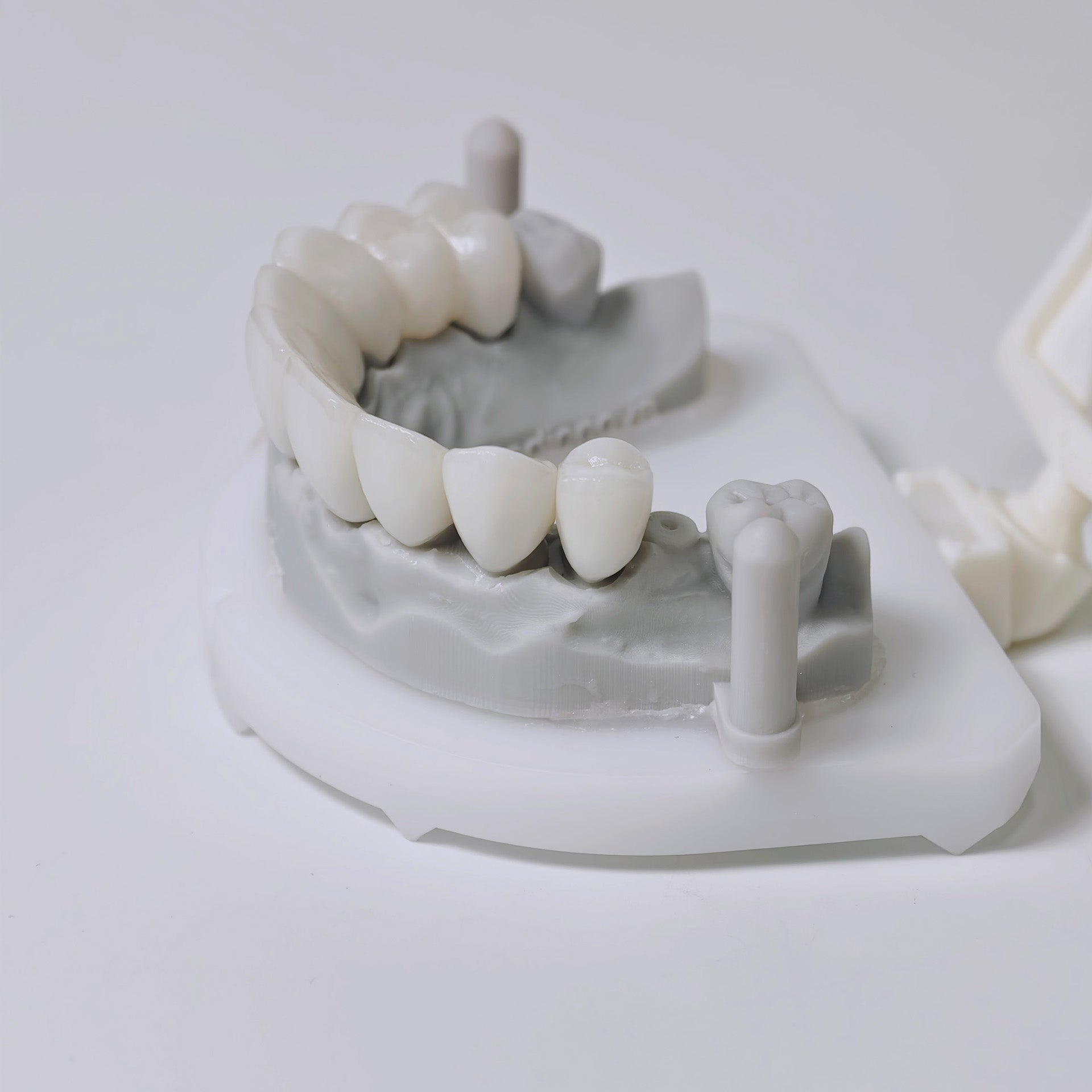 High - Strength Zirconia Bridge Aesthetic
