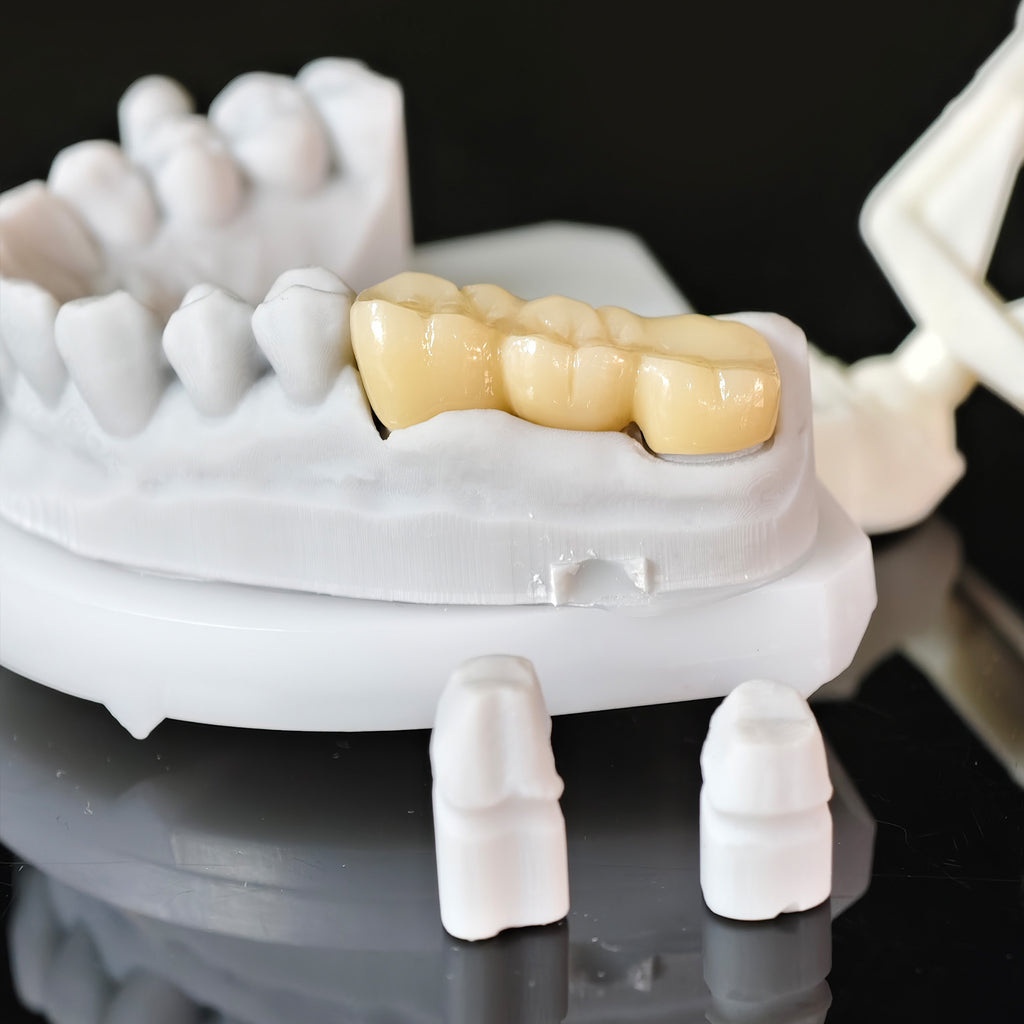 High - Strength Zirconia Bridge