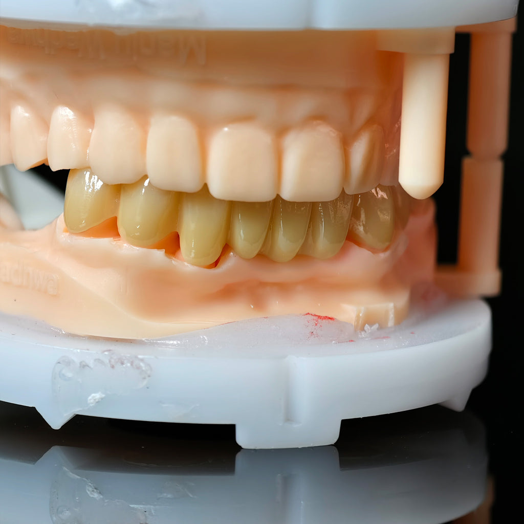 High - Strength Zirconia Bridge