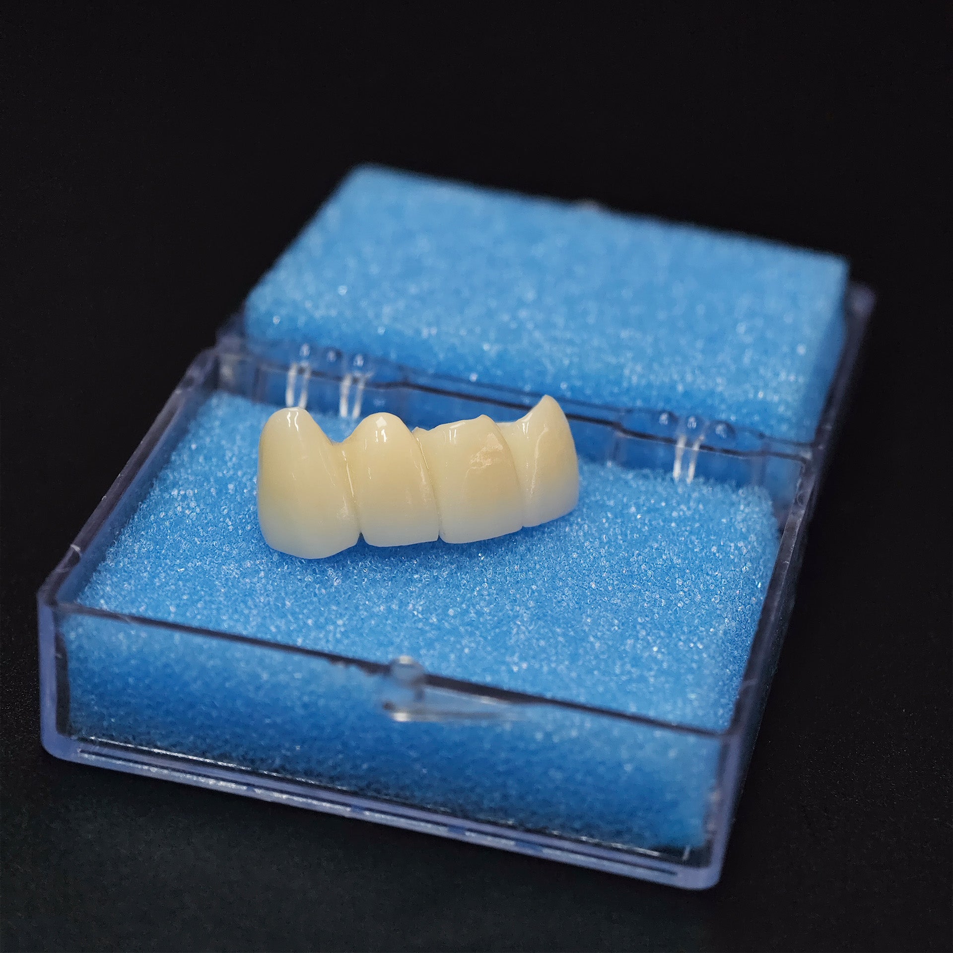 High - Strength Zirconia Bridge