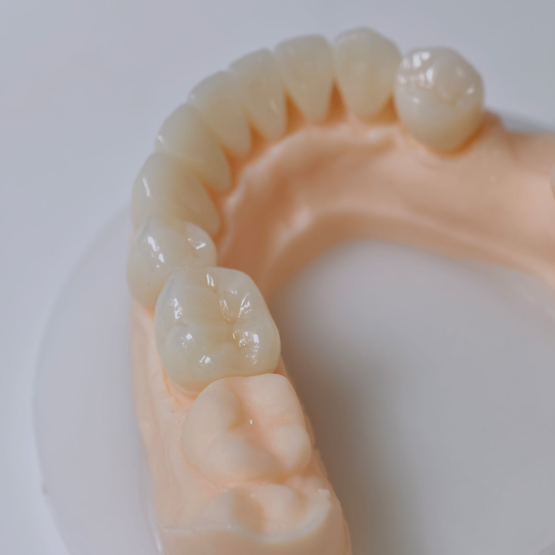 High - Strength Zirconia Bridge And Crown