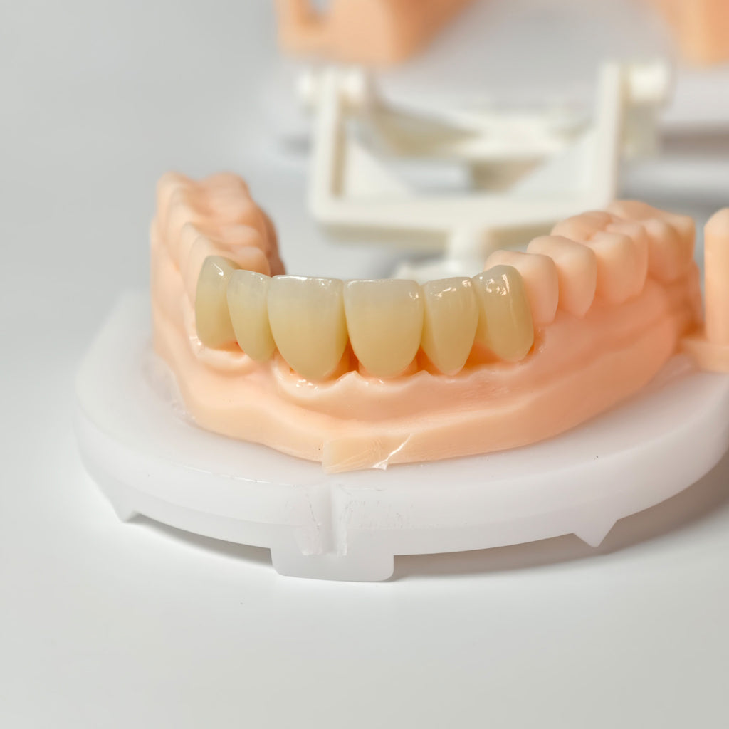 High - Strength Zirconia Bridge And Crown