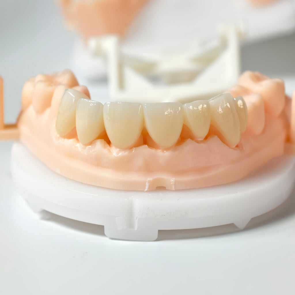High - Strength Zirconia Crown