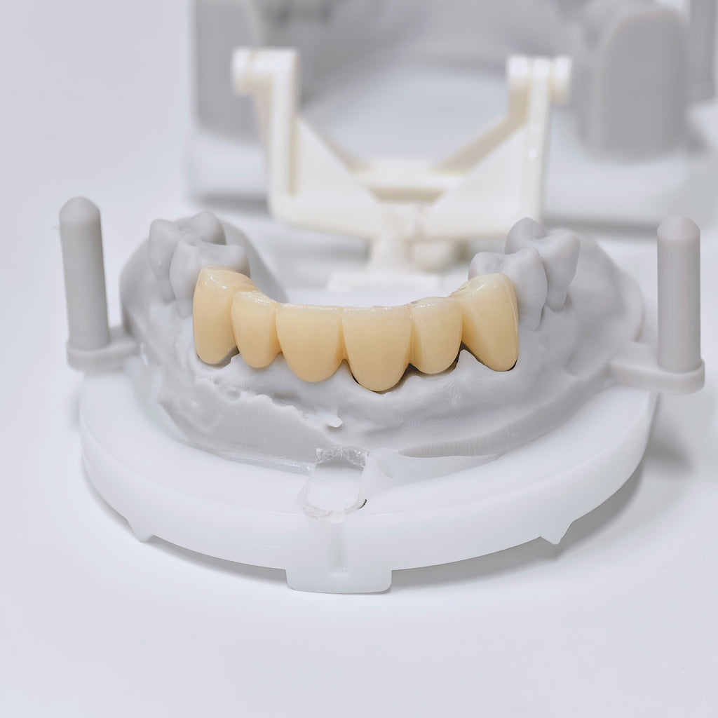 High - Strength Zirconia Crown And Bridge