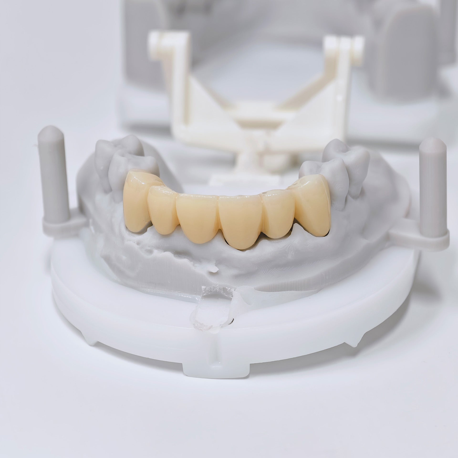 High - Strength Zirconia Crown And Bridge