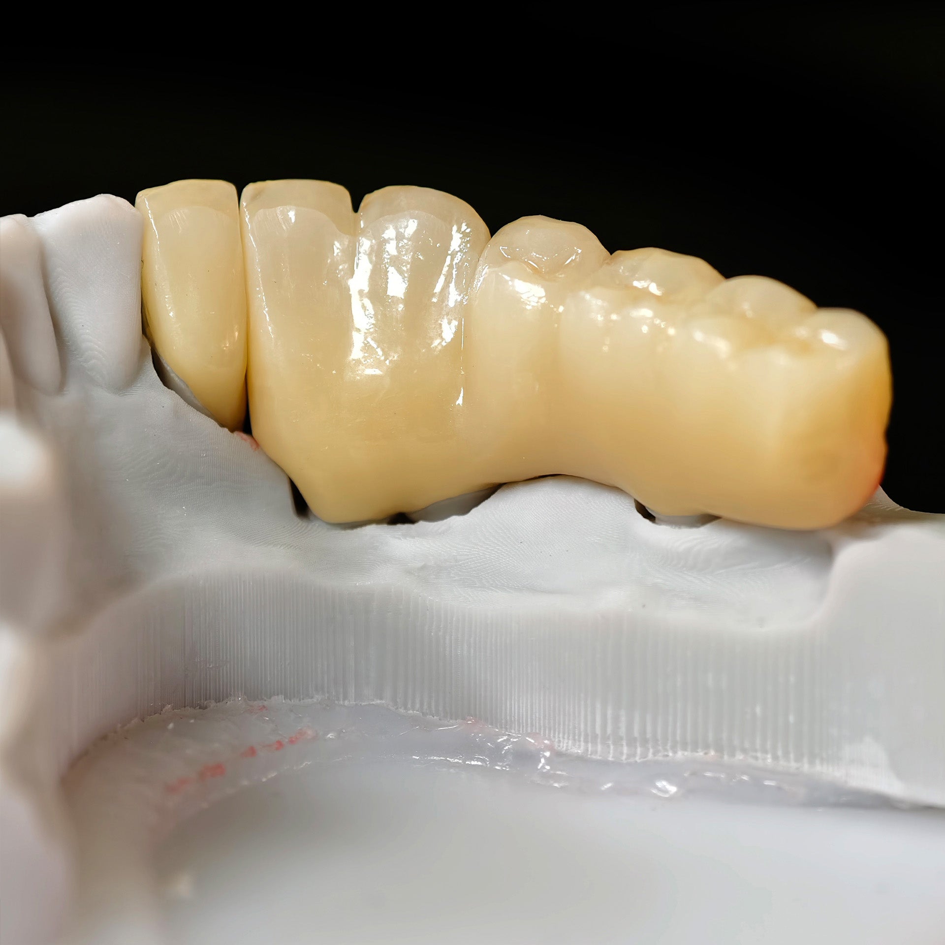 High - Strength Zirconia Crown And Bridge
