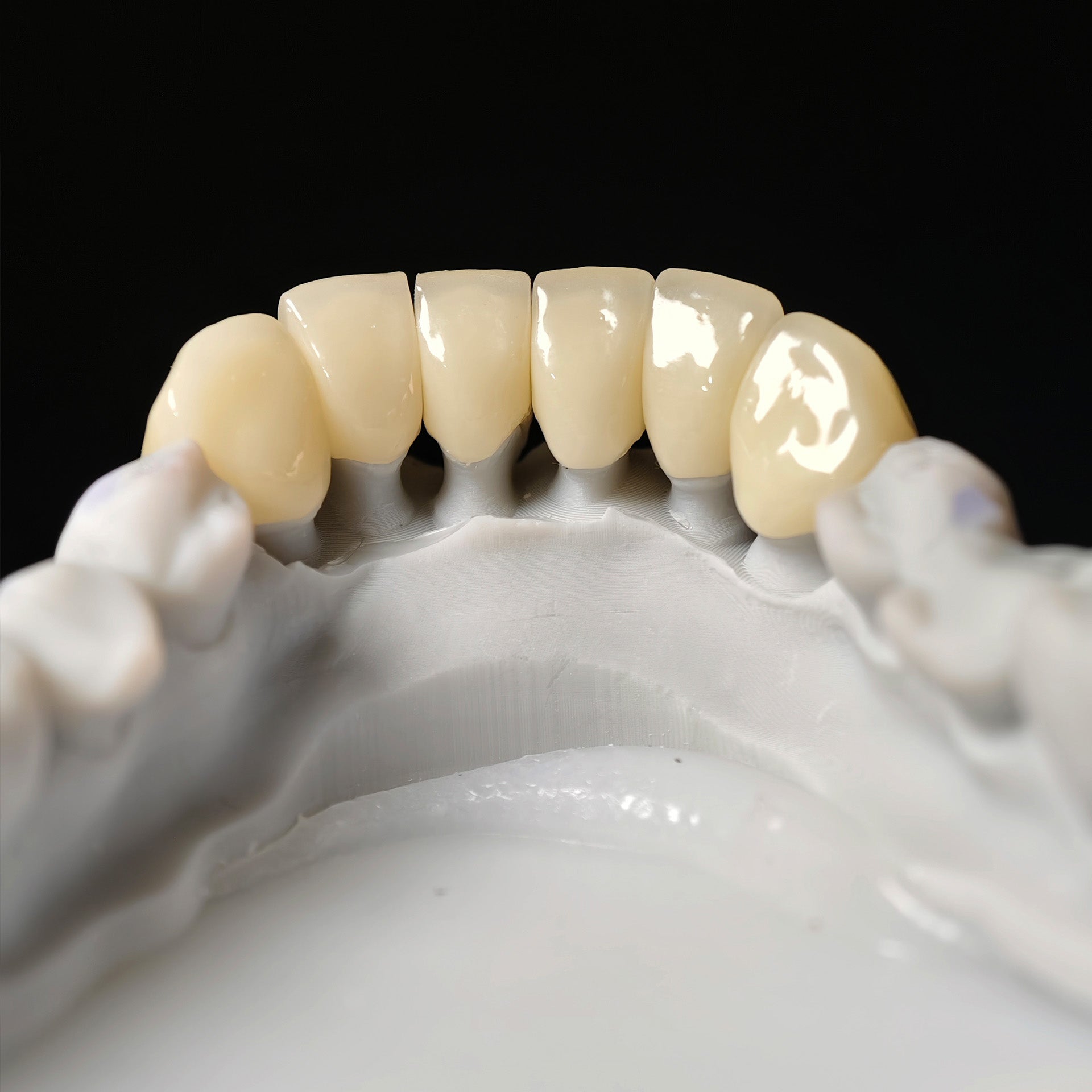 High - Strength Zirconia Crowns