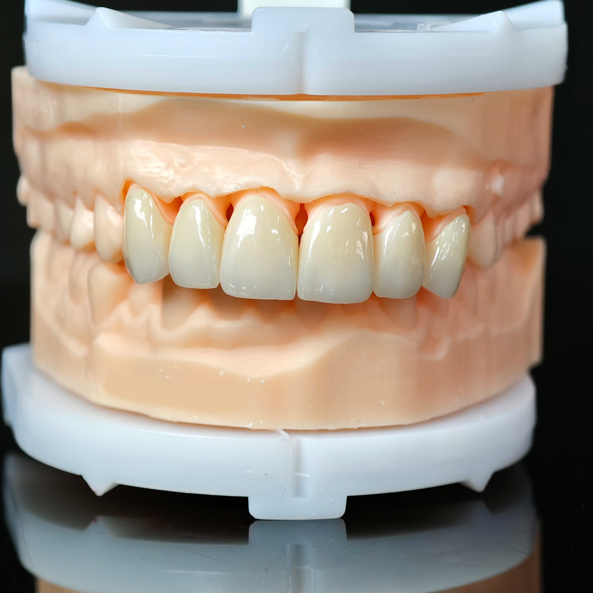 High - Strength Zirconia Crowns
