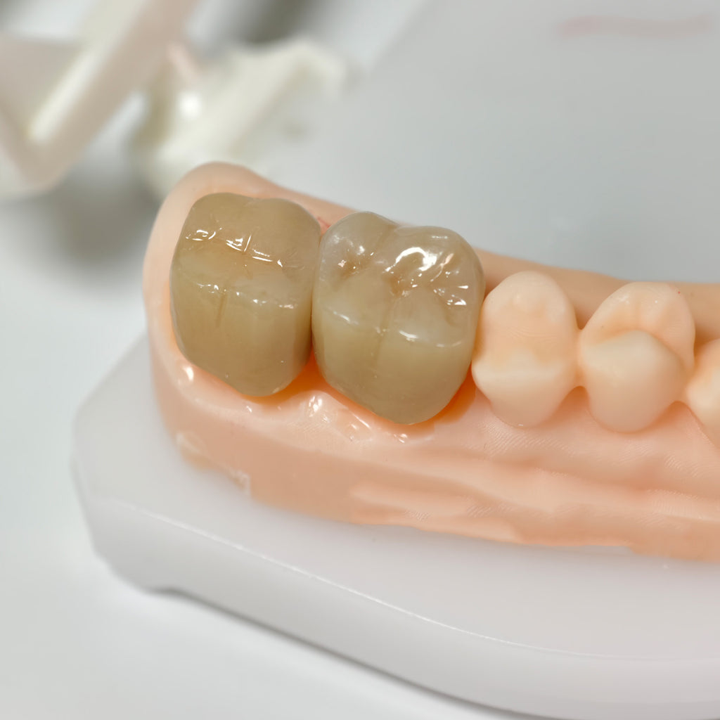 High - Strength Zirconia Crowns