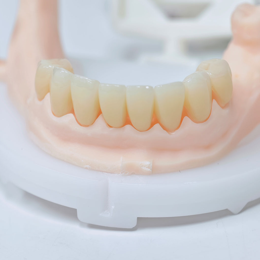 High - Strength Zirconia Crowns