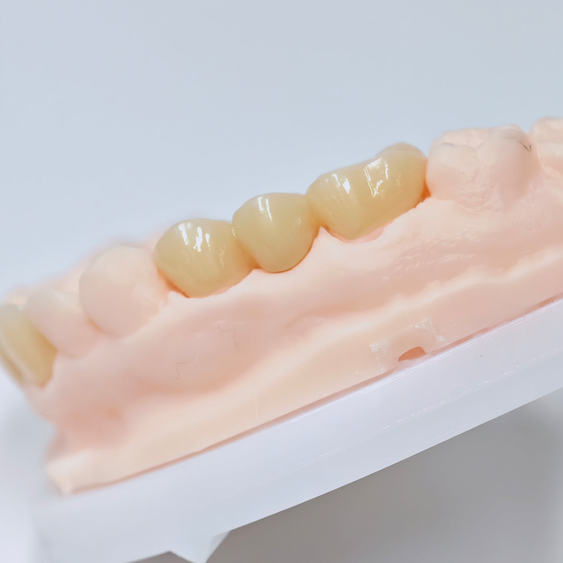 High - Strength Zirconia Crowns