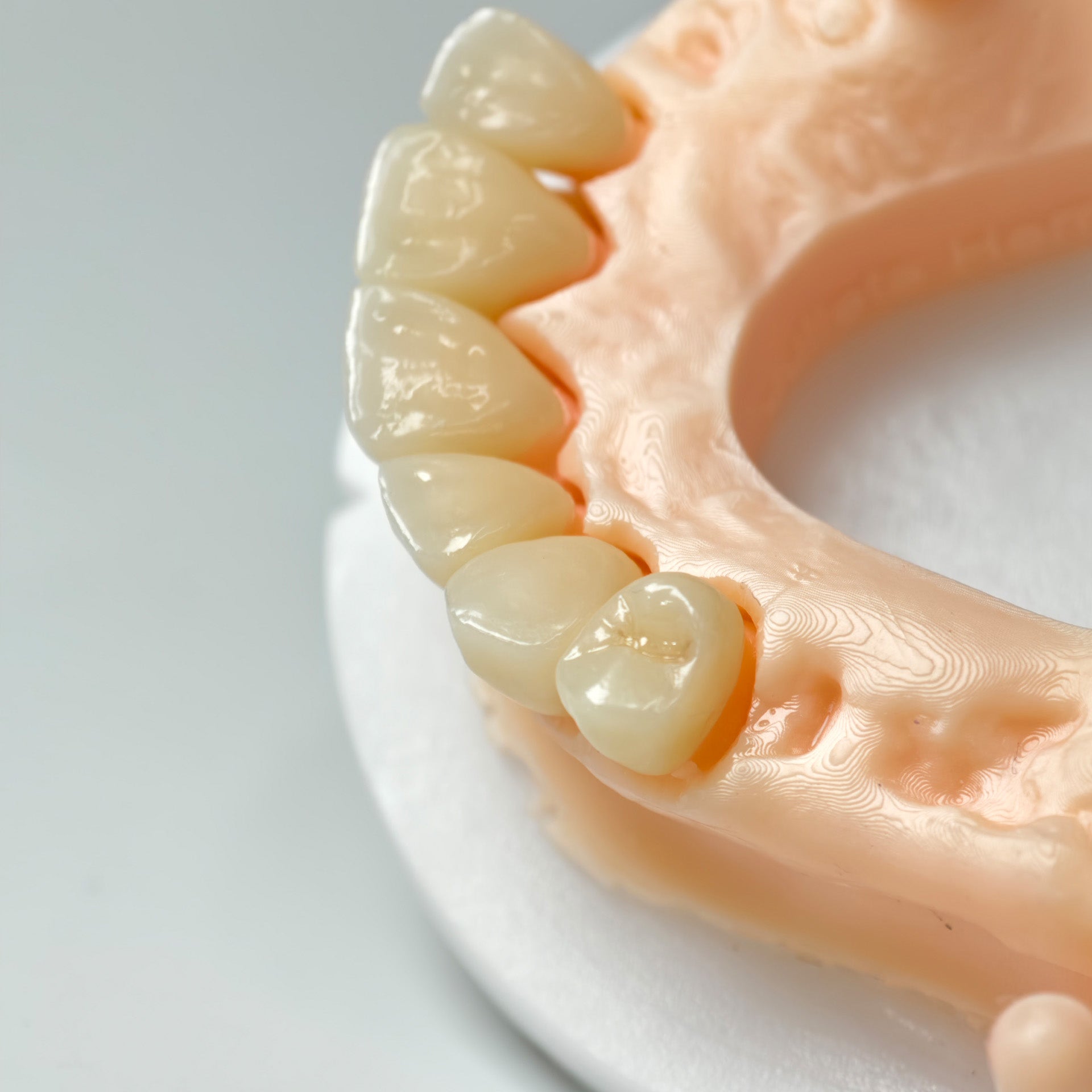 High - Strength Zirconia Crowns