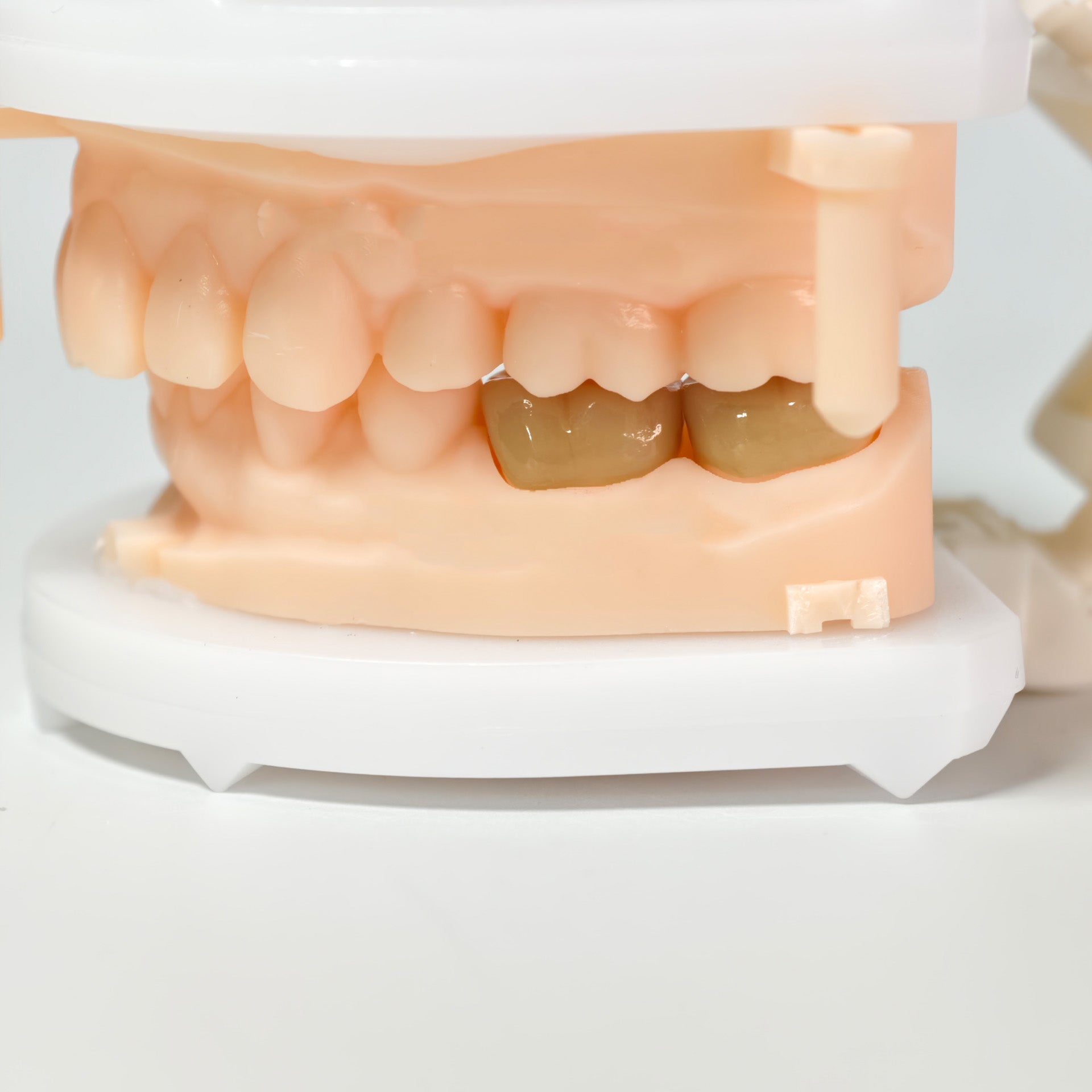 High - Strength Zirconia Crowns
