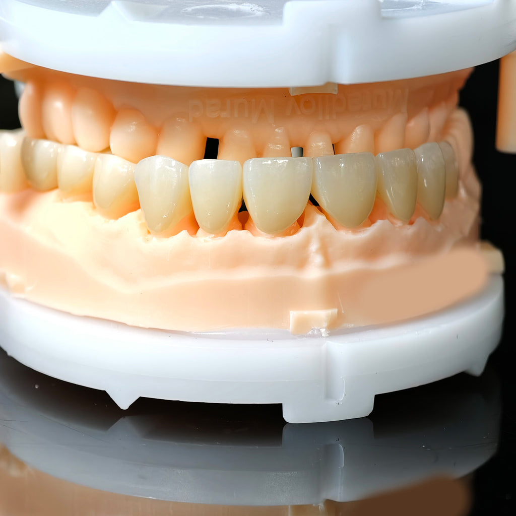 High - Strength Zirconia Crowns And Bridge