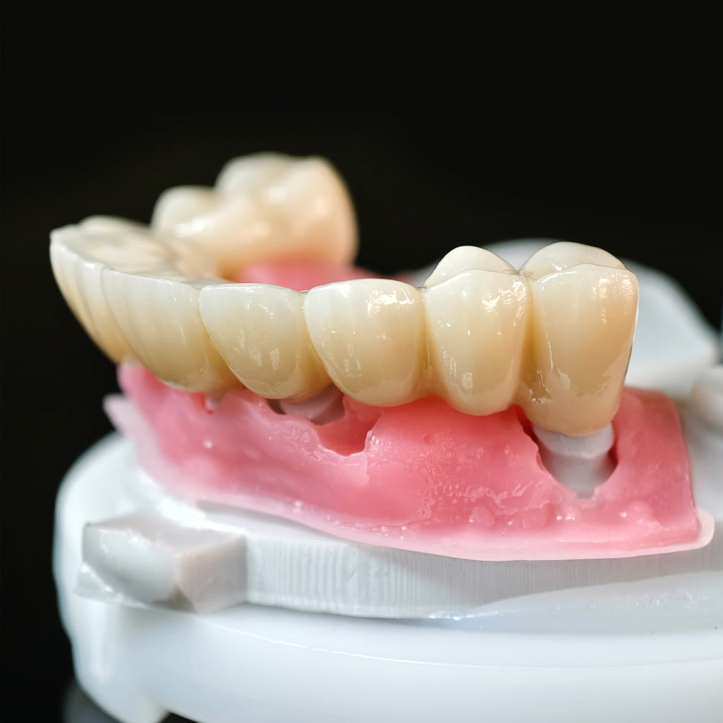 High - Strength Zirconia Crowns And Bridge