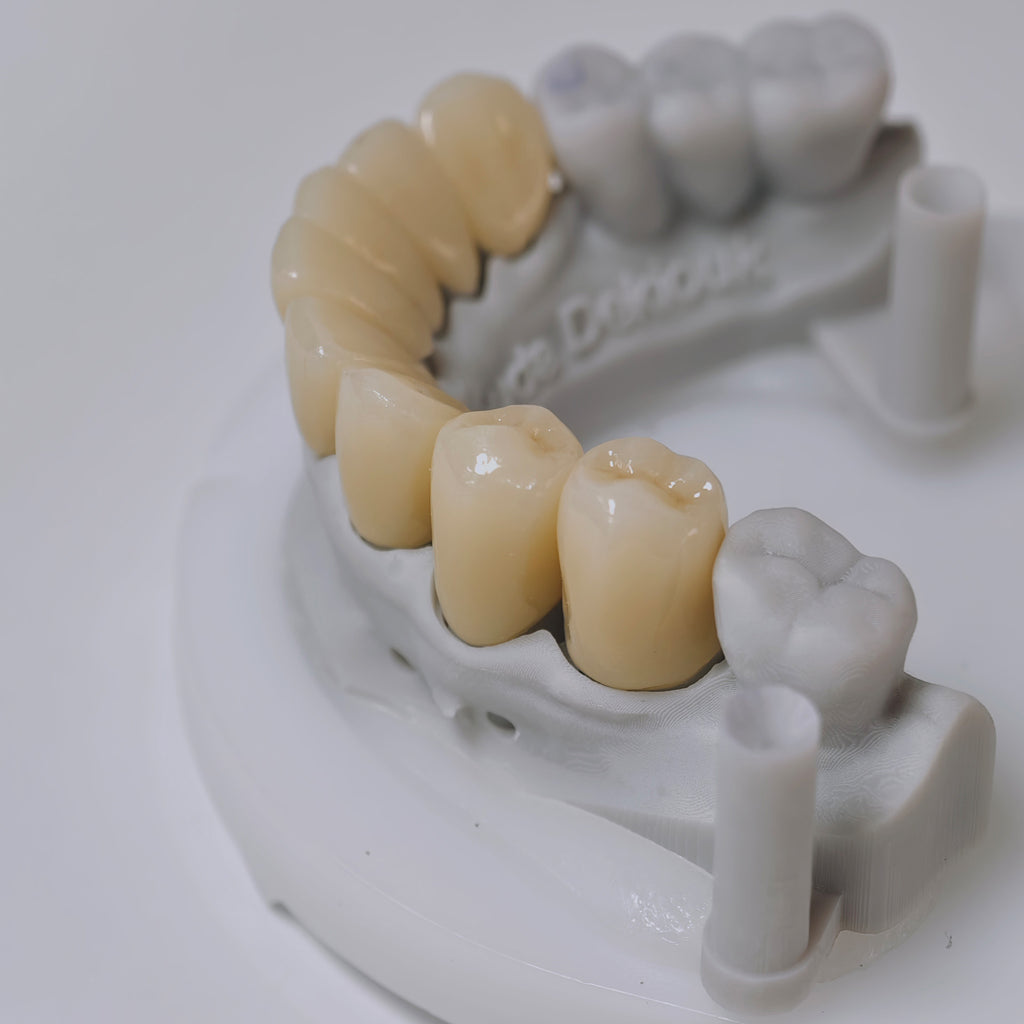 High - Strength Zirconia Crown with Post and core