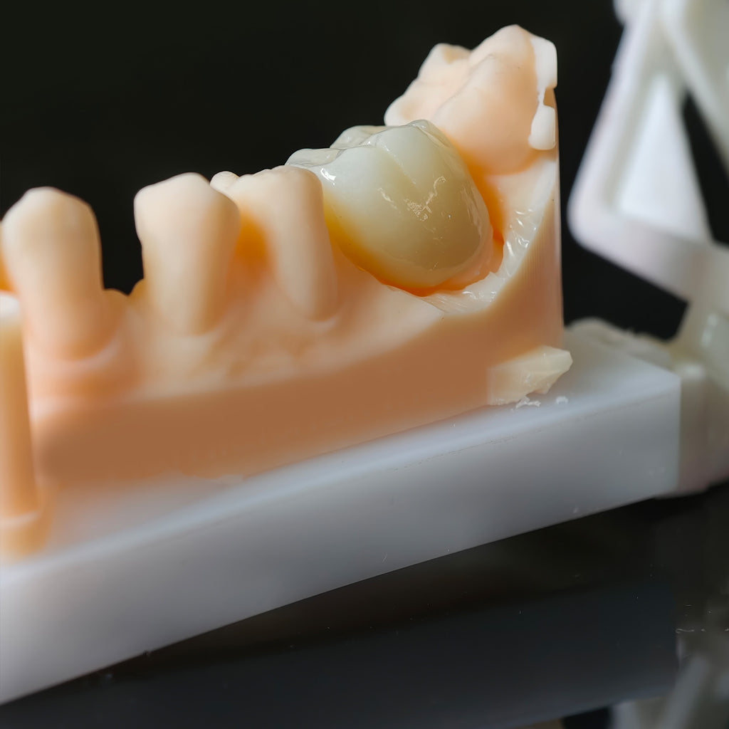 High - Strength Zirconia Dental Crown