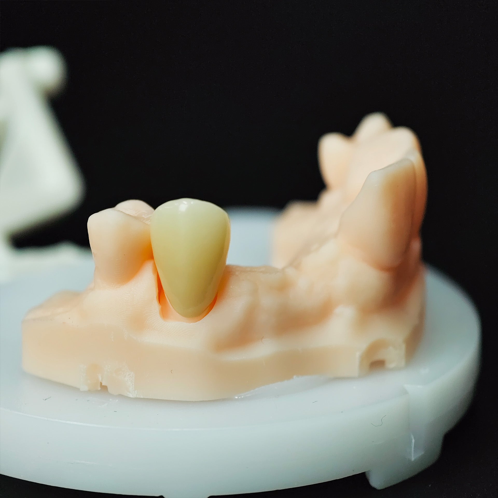 High - Strength Zirconia Crown