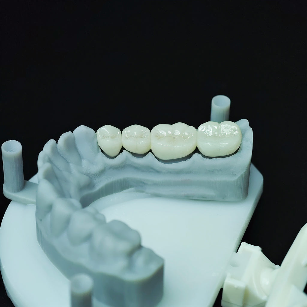 High - Strength Zirconia Crowns